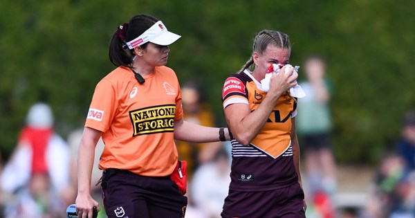 Brigginshaw's Broken Nose: A Winning Battle Scar?