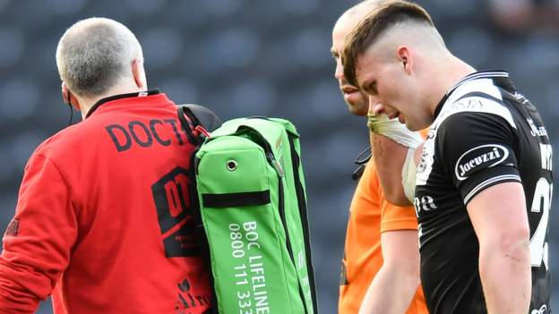 Head injury assessment and lower-limb tackle laws among RFL Board amendments