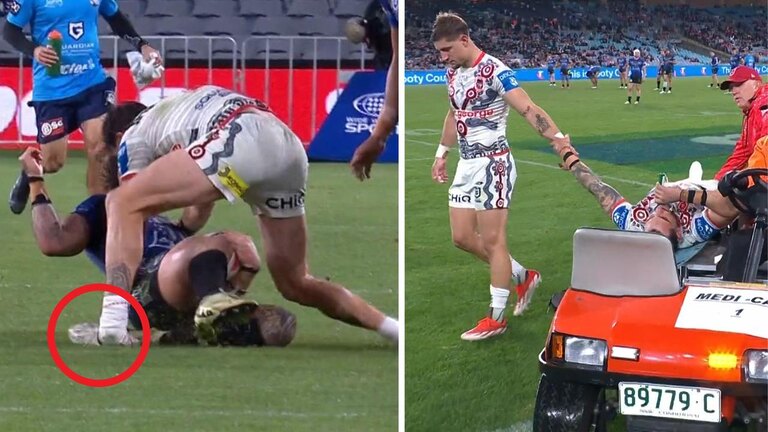 Jack Bird's ankle catastrophe rocks NRL fans