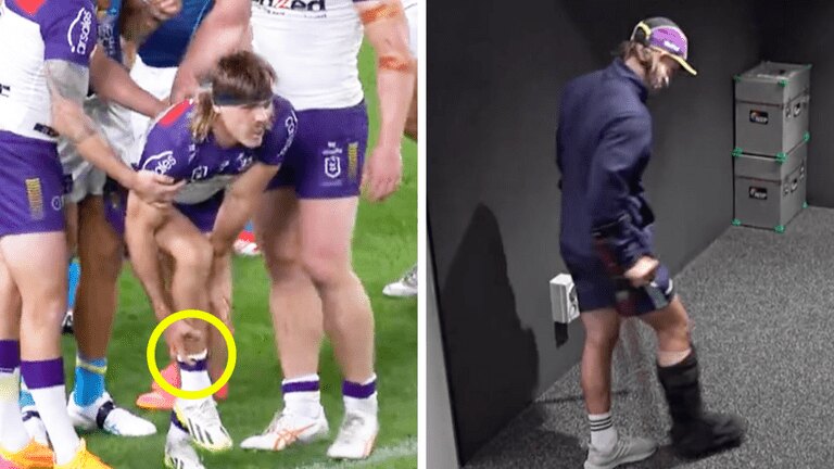 Ryan Papenhuyzen in horrible scenes as NRL world rallies around Storm fullback after update