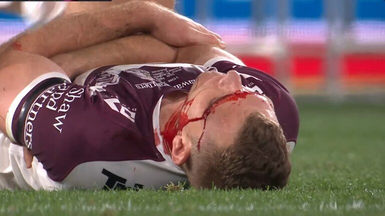 Tom's injury crushes NRL dreams: Sea Eagles shattered