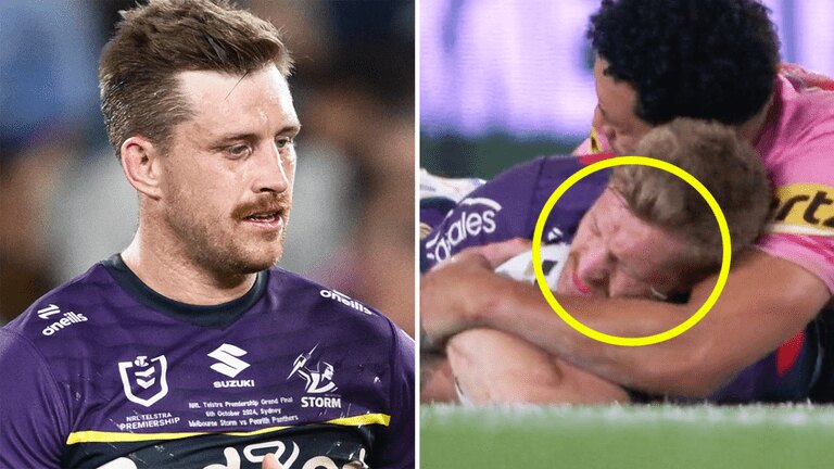 Cameron Munster cleared of 'bite' allegation by NRL