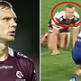 Manly's grim truth as Tom Trbojevic and Daly Cherry-Evans double blow poses major question