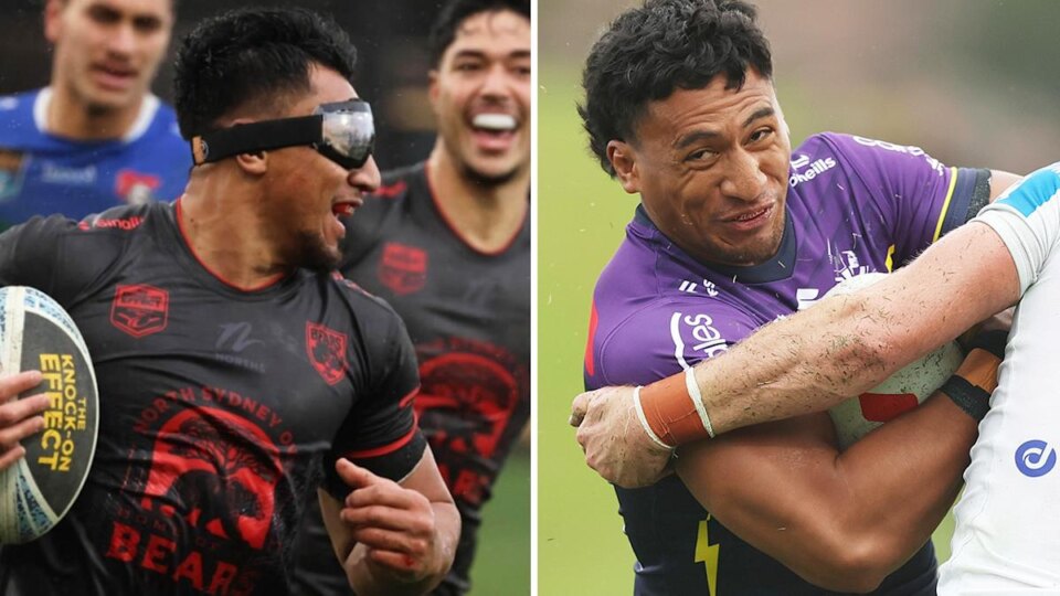 Why Melbourne Storm player Marion Seve has been forced to wear goggles on the field